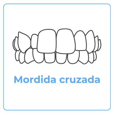 Mordida Cruzada